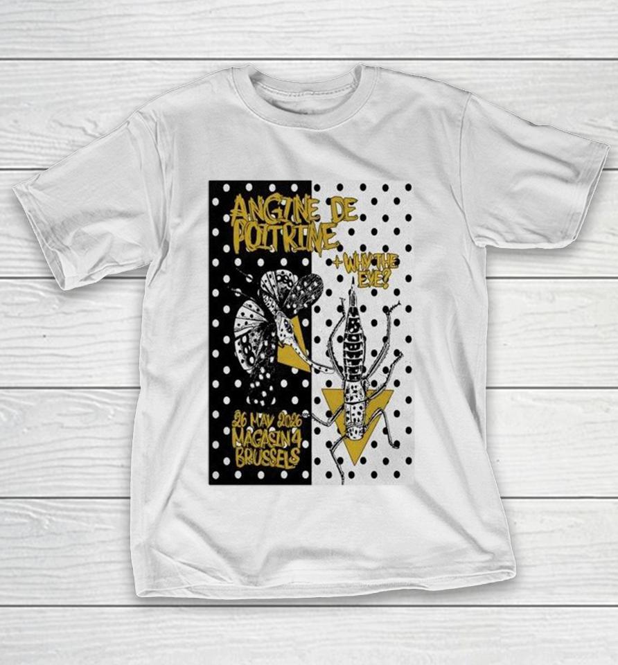 Angine De Poitrine Bruxelles Be Tour May 26 2026 Shirts 1 Angine De Poitrine Bruxelles Be Tour May 26 2026 Shirts