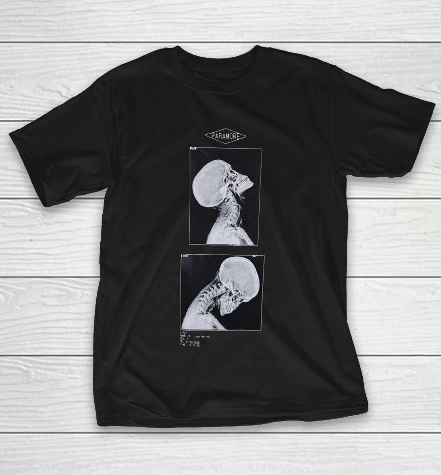 Paramore Headbang Xray Shirts 1 Paramore Headbang Xray Shirts